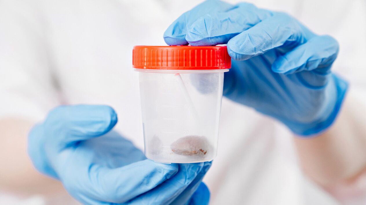 A proba máis sinxela que amosará a presenza de vermes é analizar as feces